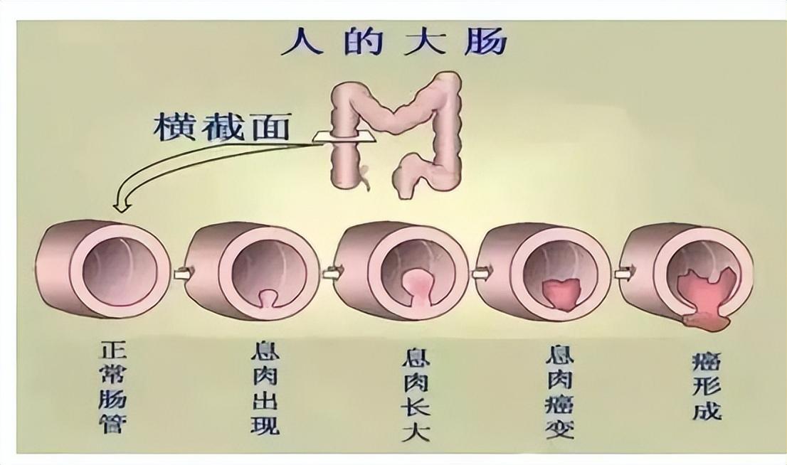 一个月婴儿三天没大便怎么办，家长指南与科学建议